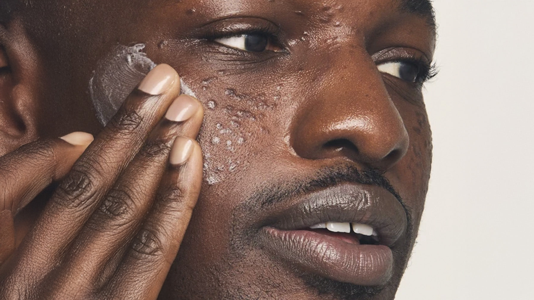 How Cold Weather Affects Sensitive and Eczema-Prone Skin and How to Keep It Under Control