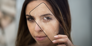 Effective Strategies to Combat Dry & Dehydrated Skin