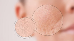 Dry vs. Dehydrated Skin: How to Tell the Difference and Treat Both This Fall
