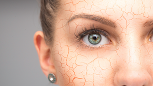 Is your skin ready for winter?