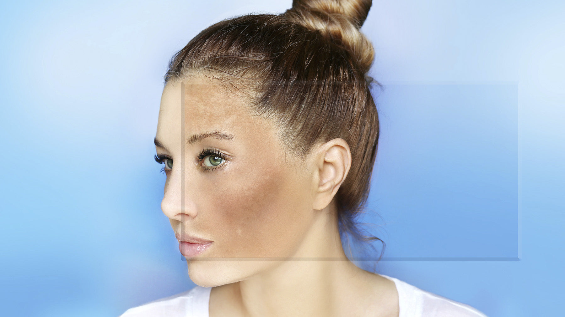 Fall Skincare for Hyperpigmentation: Why This Is the Best Season to Fade Summer Dark Spots
