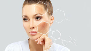 Understanding Hyperpigmentation: How Natural Ingredients Can Transform Your Skin