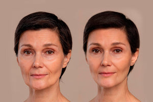 Youthful Radiance with Retinyl Palmitate: The Secret Ingredient for Aging Skin